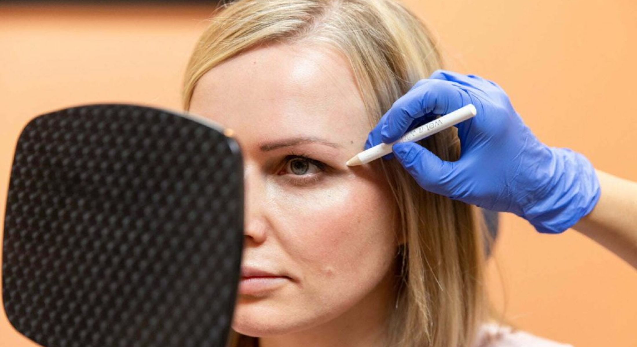 santa rosa juvederm patient receiving treatment