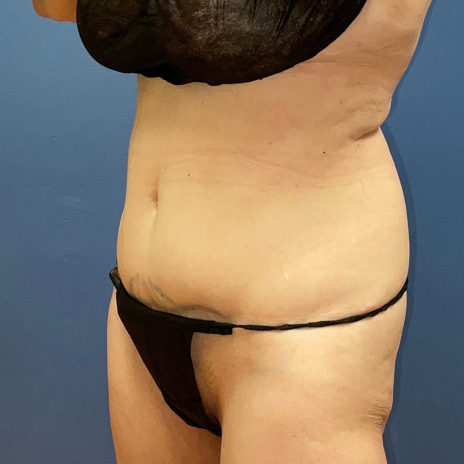 Medical Weight Loss Gallery Before & After