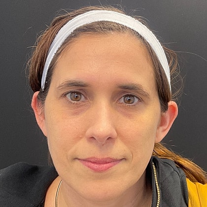 Bbl Hero Before & After