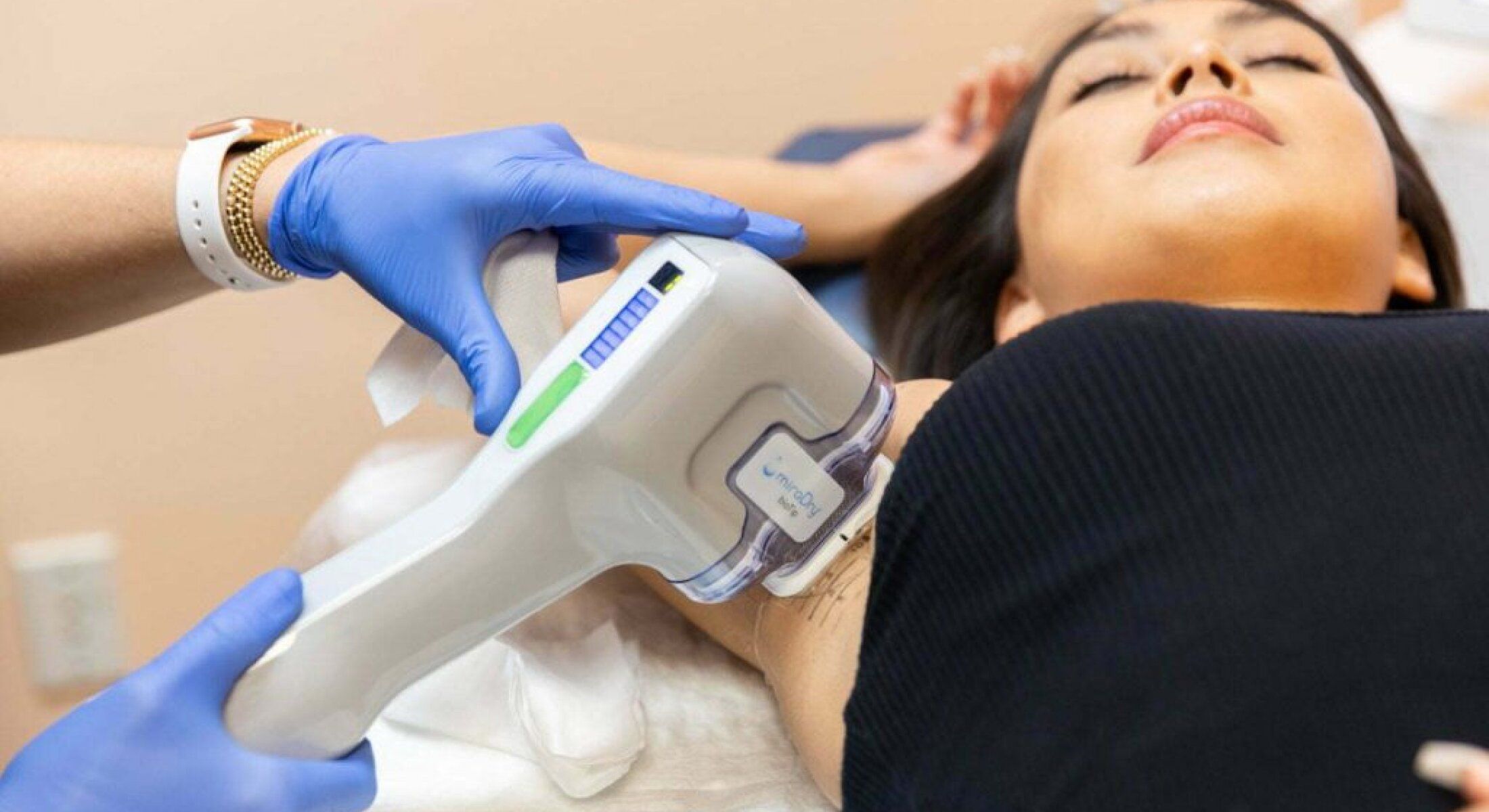 santa rosa miradry patient undergoing treatment