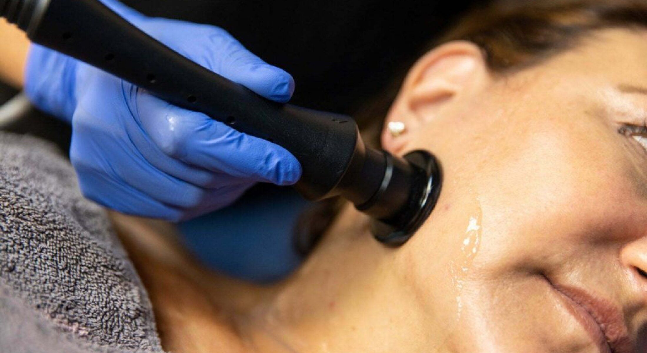 santa rosa laser skin resurfacing patient receiving treatment